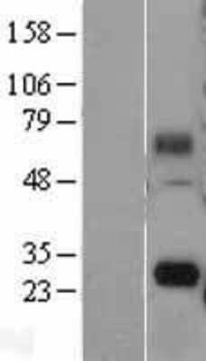 Western Blot: FAM60A Overexpression Lysate [NBL1-10548]