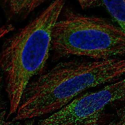 Immunocytochemistry/ Immunofluorescence: FAM62A Antibody [NBP2-57412]