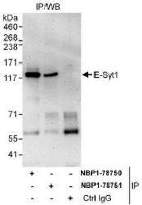 Immunoprecipitation: FAM62A Antibody [NBP1-78750]