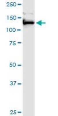 Western Blot: FAM62A Antibody [H00023344-B01P]