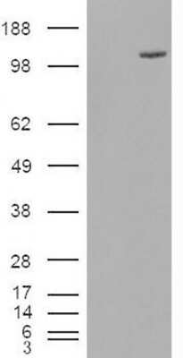 Western Blot: FAM62A Antibody [NBP1-00184]