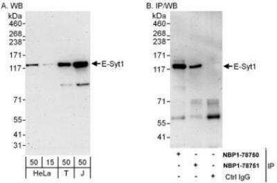 Western Blot: FAM62A Antibody [NBP1-78751]