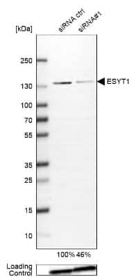 Western Blot: FAM62A Antibody [NBP1-84741]