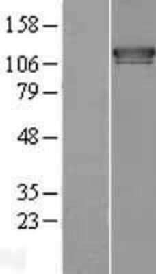 Western Blot: FAM62A Overexpression Lysate [NBL1-10549]