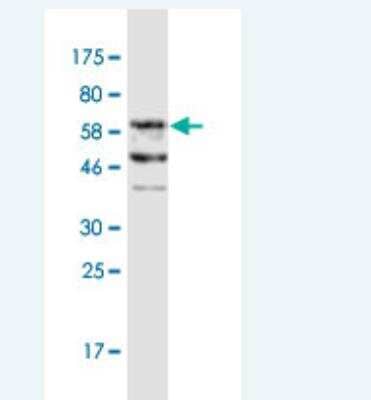 Western Blot: FAM62B Antibody (1E10) [H00057488-M05]