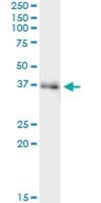Immunoprecipitation: FAM62B Antibody (4C3) [H00057488-M02]