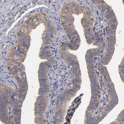 Immunohistochemistry-Paraffin: FAM62B Antibody [NBP1-85627]