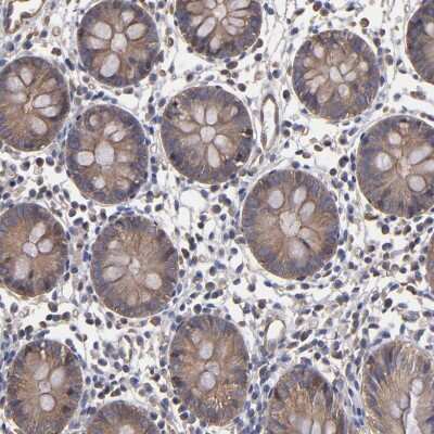 Immunohistochemistry-Paraffin: FAM62B Antibody [NBP1-85627]