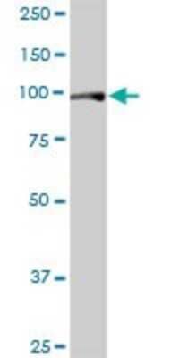 Western Blot: FAM62B Antibody [H00057488-B01P]