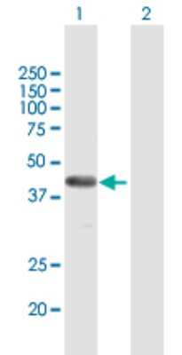Western Blot: FAM62B Antibody [H00057488-B01P]