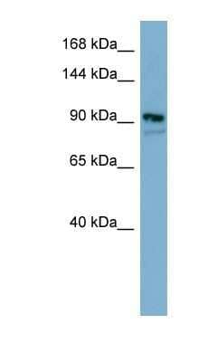 Western Blot: FAM62B Antibody [NBP1-59988]