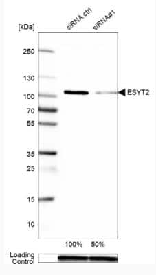 Western Blot: FAM62B Antibody [NBP1-85627]