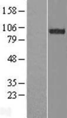 Western Blot: FAM62B Overexpression Lysate [NBL1-10550]