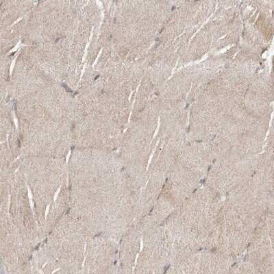 Immunohistochemistry-Paraffin: FAM63A Antibody [NBP1-83758]