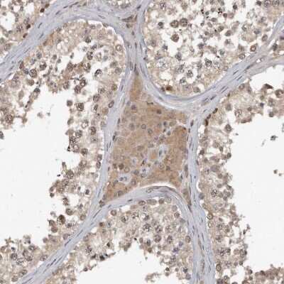 Immunohistochemistry-Paraffin: FAM63A Antibody [NBP1-83758]