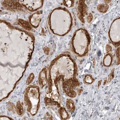 Immunohistochemistry-Paraffin: FAM63A Antibody [NBP1-83758]