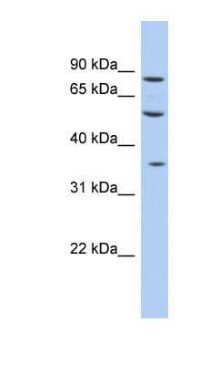 Western Blot: FAM63A Antibody [NBP1-56831]