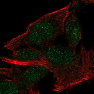 Immunocytochemistry/ Immunofluorescence: MINDY2 Antibody [NBP2-57857]