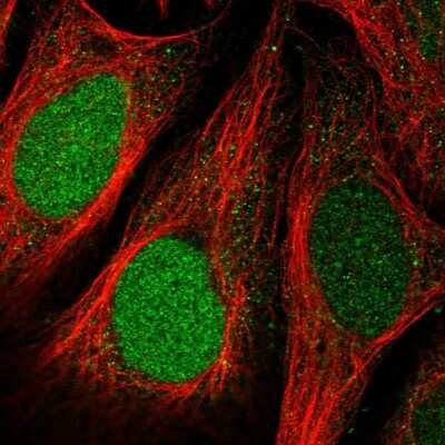 Immunocytochemistry/ Immunofluorescence: FAM64A Antibody [NBP2-14002]