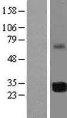 Western Blot: FAM64A Overexpression Lysate [NBL1-10552]