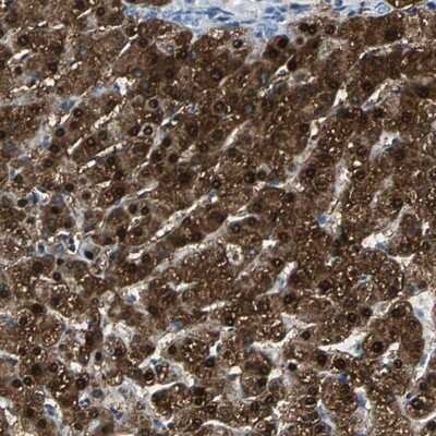 Immunohistochemistry-Paraffin: FAM65A Antibody [NBP1-83695]