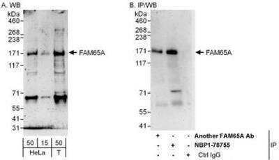 Western Blot: FAM65A Antibody [NBP1-78755]