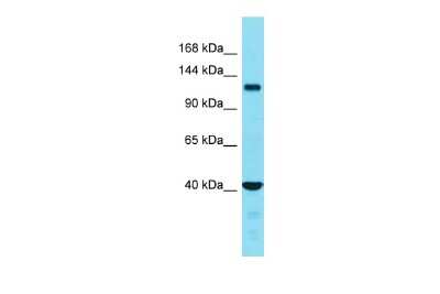 Western Blot: FAM65A Antibody [NBP2-87425]