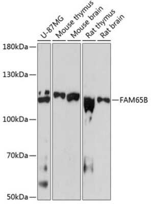 Western Blot: FAM65B AntibodyAzide and BSA Free [NBP3-04522]