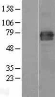 Western Blot: FAM65B Overexpression Lysate [NBL1-10553]