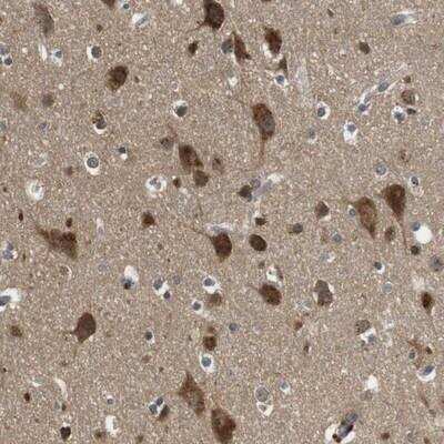 Immunohistochemistry-Paraffin: FAM69A Antibody [NBP1-93928]