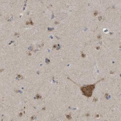 Immunohistochemistry-Paraffin: FAM69A Antibody [NBP1-93929]