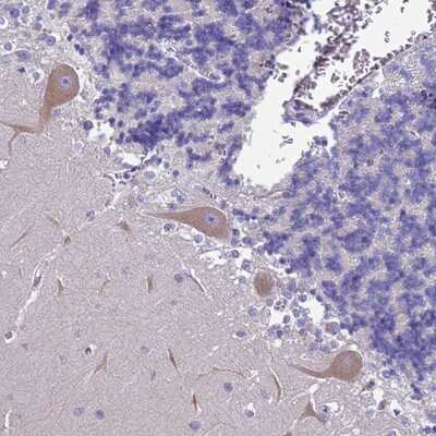 Immunohistochemistry-Paraffin: FAM69B Antibody [NBP2-14576]