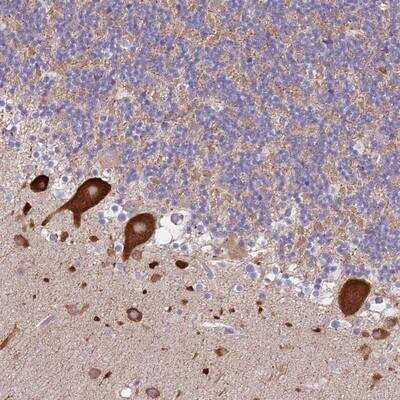 Immunohistochemistry-Paraffin: FAM69C Antibody [NBP2-14666]