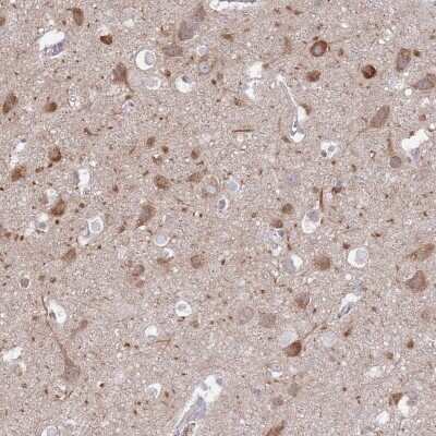 Immunohistochemistry-Paraffin: FAM69C Antibody [NBP2-14666]