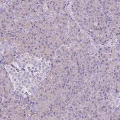 Immunohistochemistry-Paraffin: FAM69C Antibody [NBP2-14666]