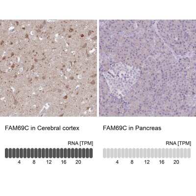 Immunohistochemistry-Paraffin: FAM69C Antibody [NBP2-14666]