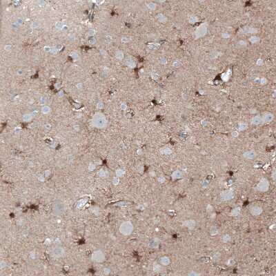 Immunohistochemistry-Paraffin: FAM70A Antibody [NBP2-30639]