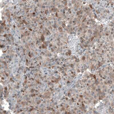 Immunohistochemistry-Paraffin: FAM70A Antibody [NBP2-30639]