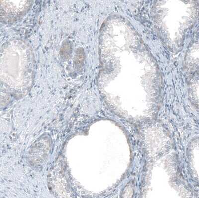 Immunohistochemistry-Paraffin: FAM70A Antibody [NBP2-30639]