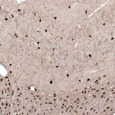 Immunohistochemistry-Paraffin: FAM70A Antibody [NBP2-30639]