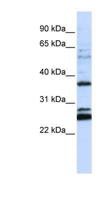 Western Blot: FAM70A Antibody [NBP1-59972]