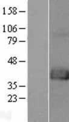 Western Blot: FAM70A Overexpression Lysate [NBL1-10556]