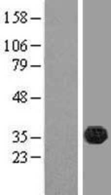 Western Blot: FAM70B Overexpression Lysate [NBL1-10557]