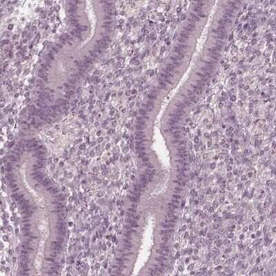 Immunohistochemistry-Paraffin: FAM71A Antibody [NBP1-83516]