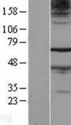 Western Blot: FAM71A Overexpression Lysate [NBL1-10558]