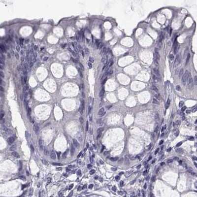 Immunohistochemistry-Paraffin: FAM71B Antibody [NBP1-82720]