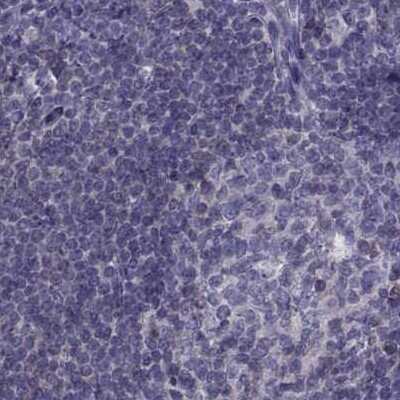 Immunohistochemistry-Paraffin: FAM71B Antibody [NBP1-82721]