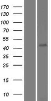 Western Blot: FAM71D Overexpression Lysate [NBP2-05112]