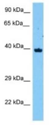 Western Blot: FAM71F1 Antibody [NBP3-10224]