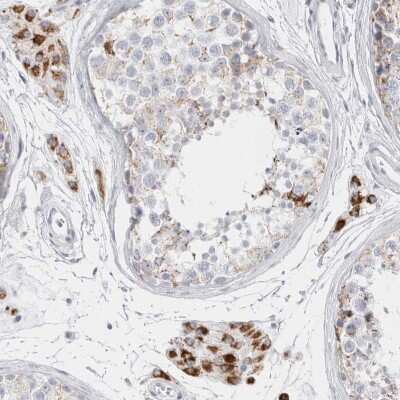 Immunohistochemistry-Paraffin: FAM71F2 Antibody [NBP2-38135]